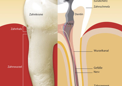 Wurzelbehandlung 1