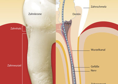 Wurzelbehandlung 3